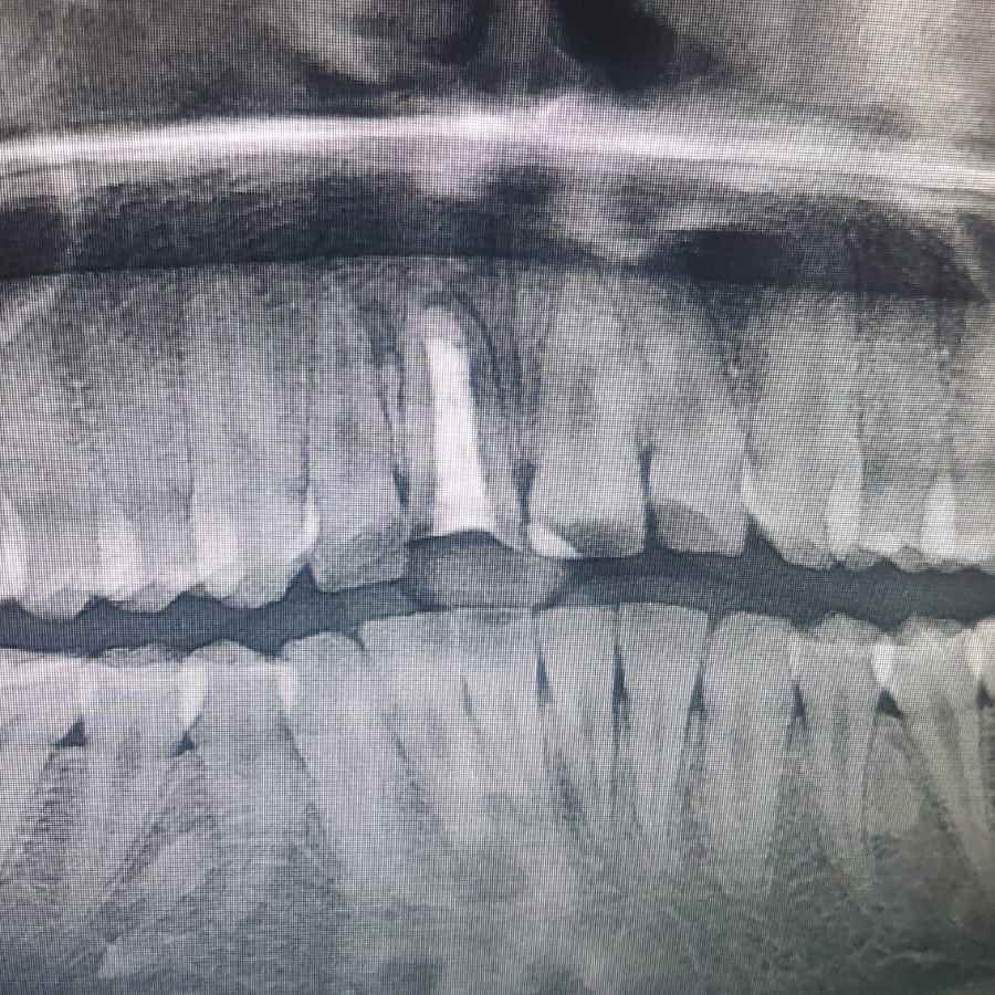bahçelievler endodonti