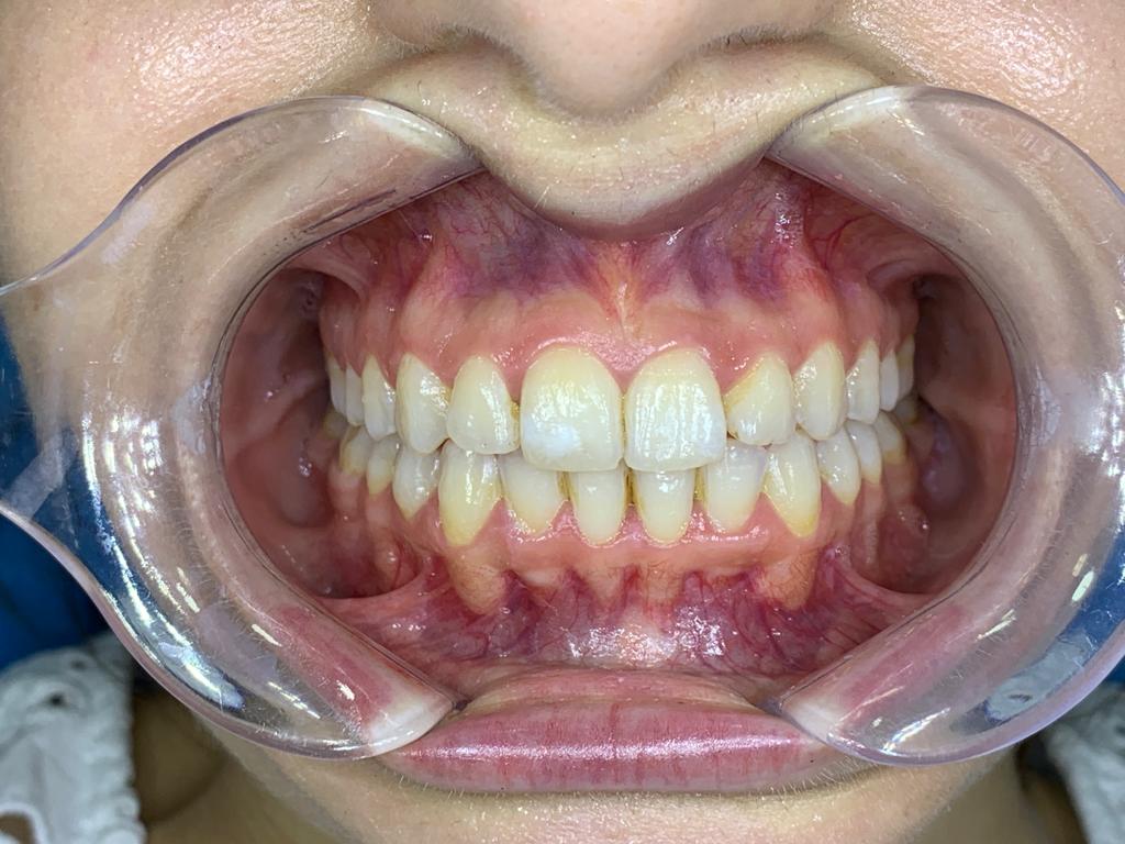 esenler ortodonti tedavisi